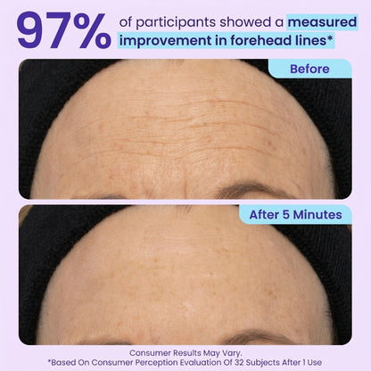 SPECIAL LAUNCH PRICE | GOPURE™ Instant Lift Eye Gel | For Puffiness & Bags, Wrinkles, Fine Lines and Dark Circles