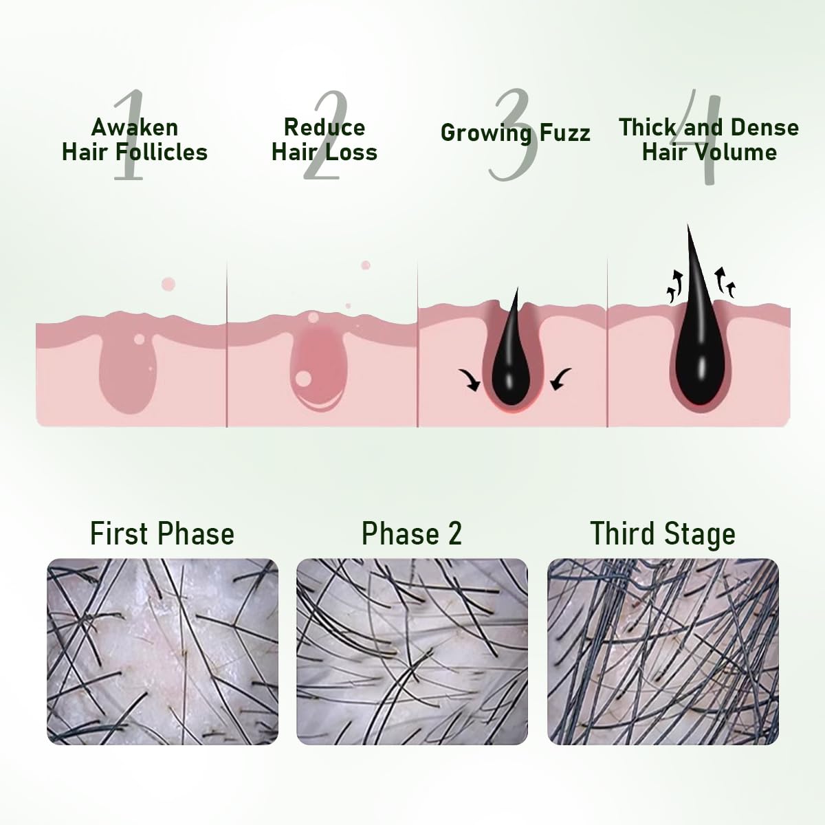 Gypsophila® BATANA OIL HAIR GROWTH BUNDLE