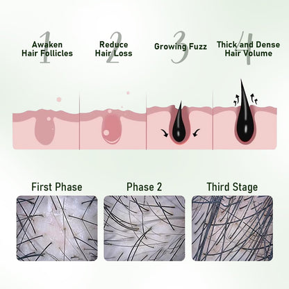 Gypsophila® BATANA OIL HAIR GROWTH BUNDLE