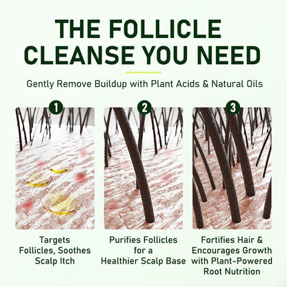 Gypsophila® HAIR FOLLICLE CLEANING SHAMPOO