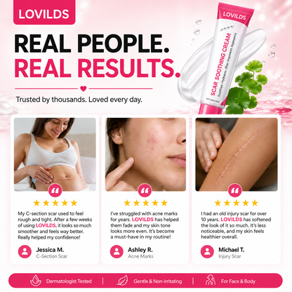 🔥LAST DAY Buy 1 Get 1 Free🔥Scar free wart removal cream
